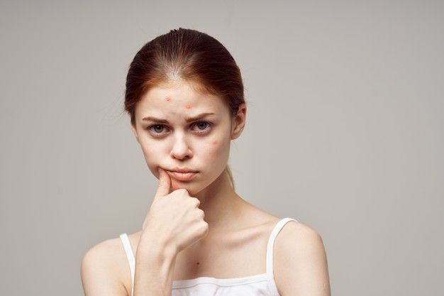 perempuan sedang risau