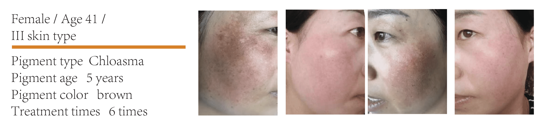 BEFORE AFTER PRIME 450-10