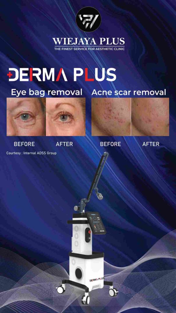 before after derma plus 1_11zon