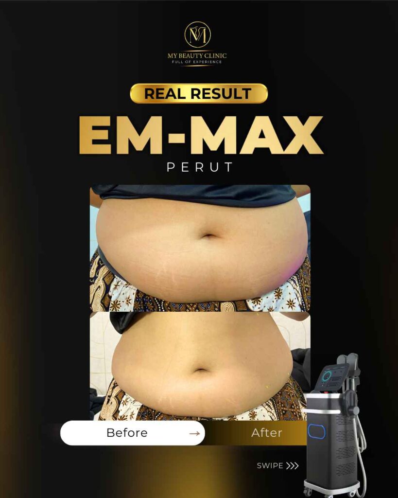 alat treatment untuk body goal