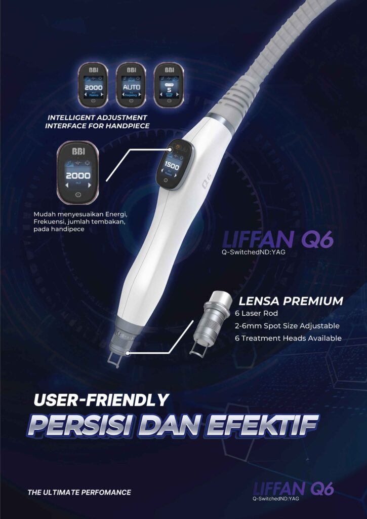 LIFFAN Q6 Laser nd yag