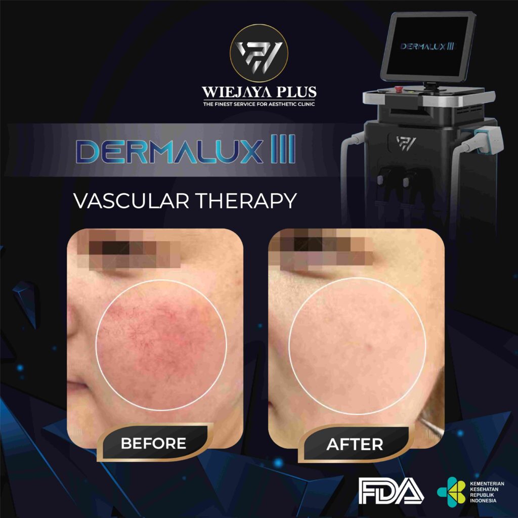 alat klinik kecantikan di wiejayaplus