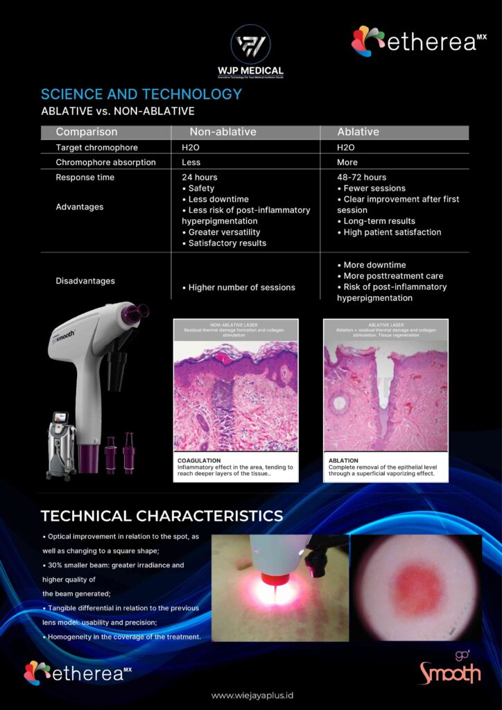 Teknologi GoSmooth Etherea MX untuk klinik kecantikan